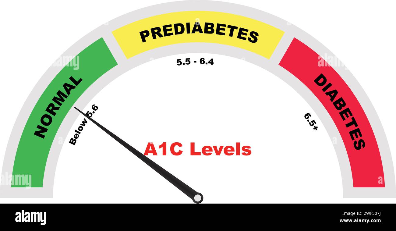 A1C test Meter, diagnosi prediabete, test ematico emoglobina, provetta con sangue, test medico di sangue, risultato negativo Illustrazione Vettoriale