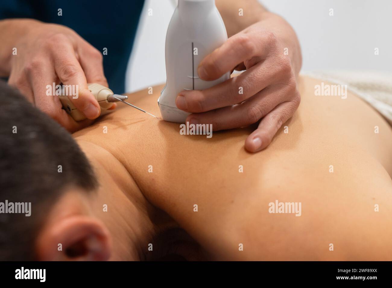 Immagine ravvicinata che mostra un operatore sanitario che esegue un'ecografia sulla schiena del paziente con un trasduttore e un gel Foto Stock