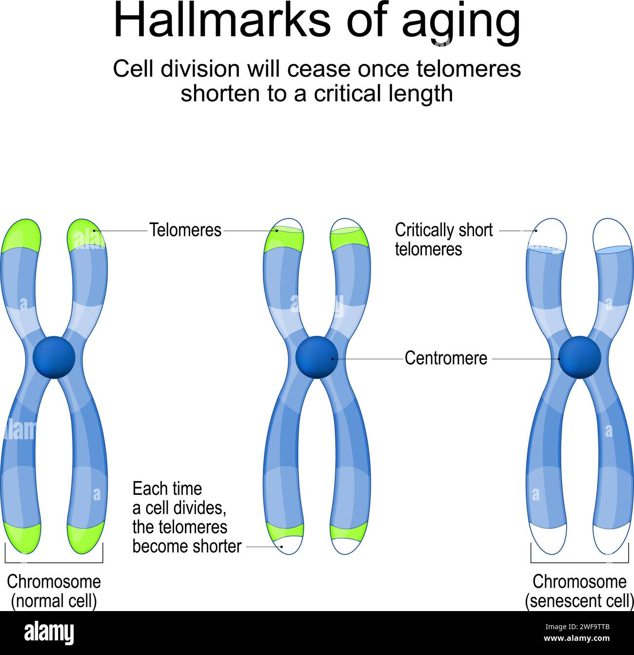 Segni distintivi dell'invecchiamento. Cromosomi con telomeri prima e dopo la divisione delle cellule nuove e senescenti. La divisione cellulare si interrompe una volta che i telomeri si accorciano a. Illustrazione Vettoriale