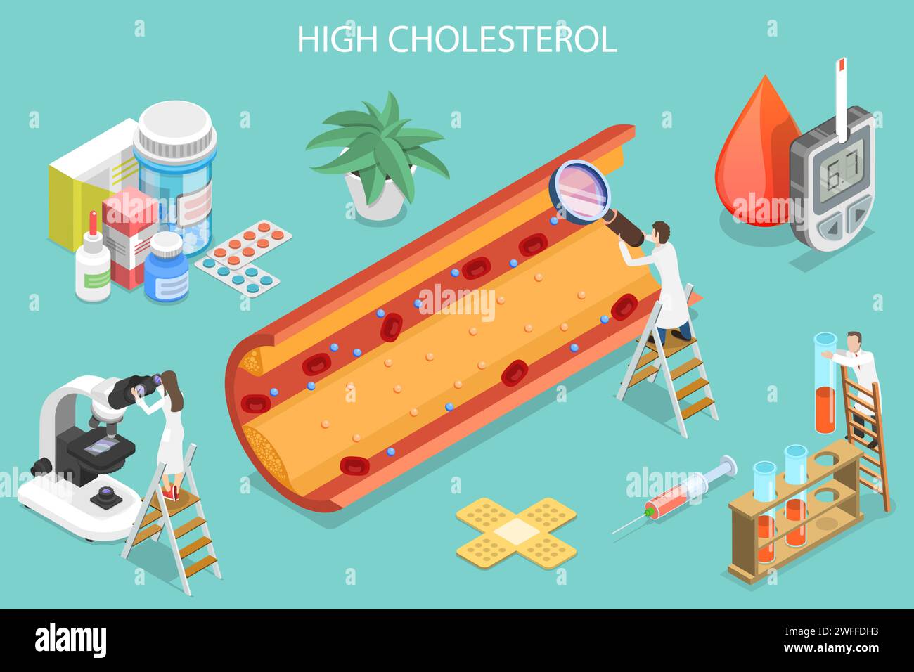 Illustrazione concettuale del vettore piatto isometrico 3D di alto livello di colesterolo, rischio per la salute, flusso sanguigno. Illustrazione Vettoriale