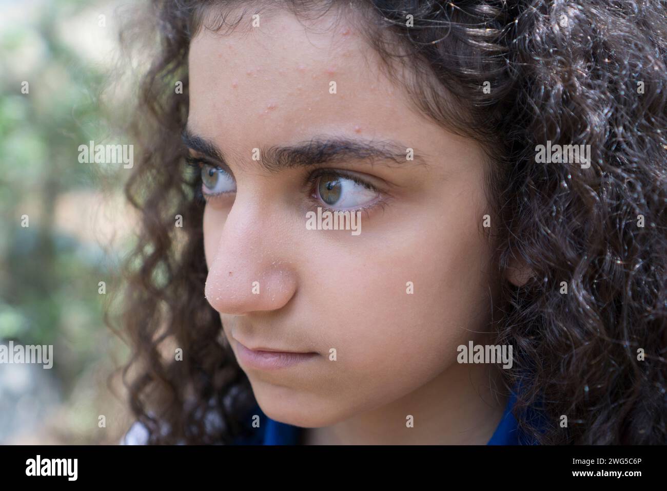 Primo piano di una ragazza mediorientale con l'acne sulla fronte che guarda lontano Foto Stock