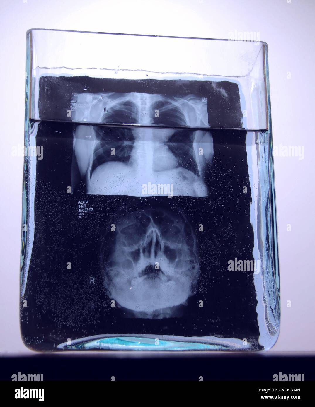 Immagine a raggi X con risultati di analisi radiografiche cerebrali umane in un vaso rettangolare di vetro Foto Stock