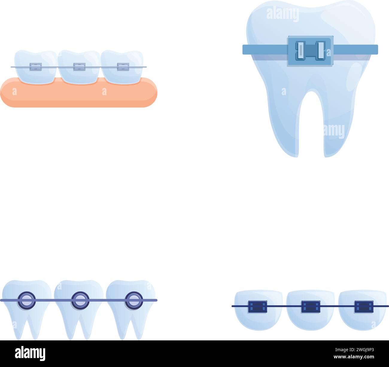 Le icone di allineamento dei denti impostano il vettore dei cartoni animati. Sistema di rinforzo ortodontico sui denti. Trattamento ortodontico Illustrazione Vettoriale