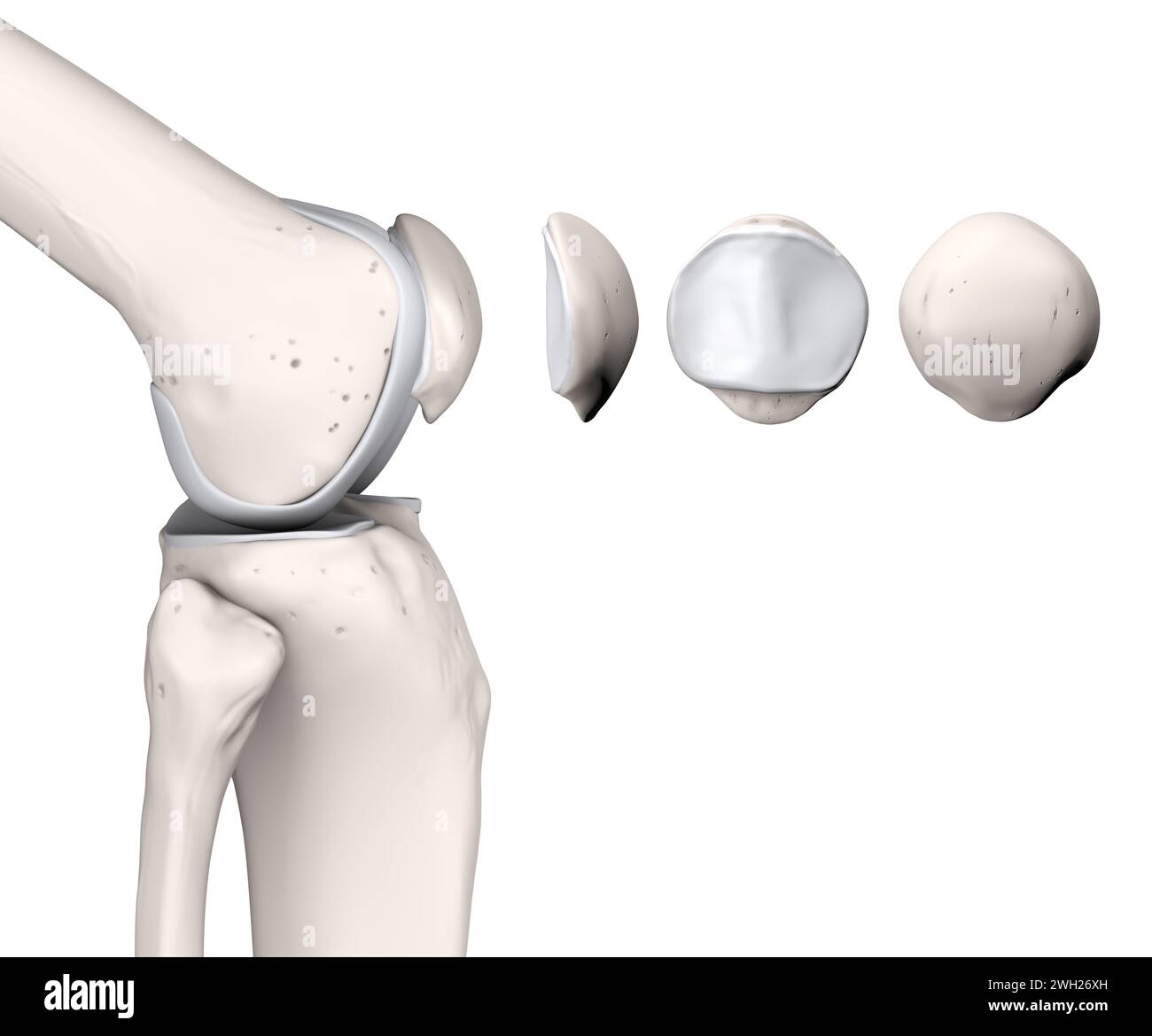 Illustrazione 3D medica che mostra l'anatomia sana dell'articolazione del ginocchio. Rotula. Foto Stock