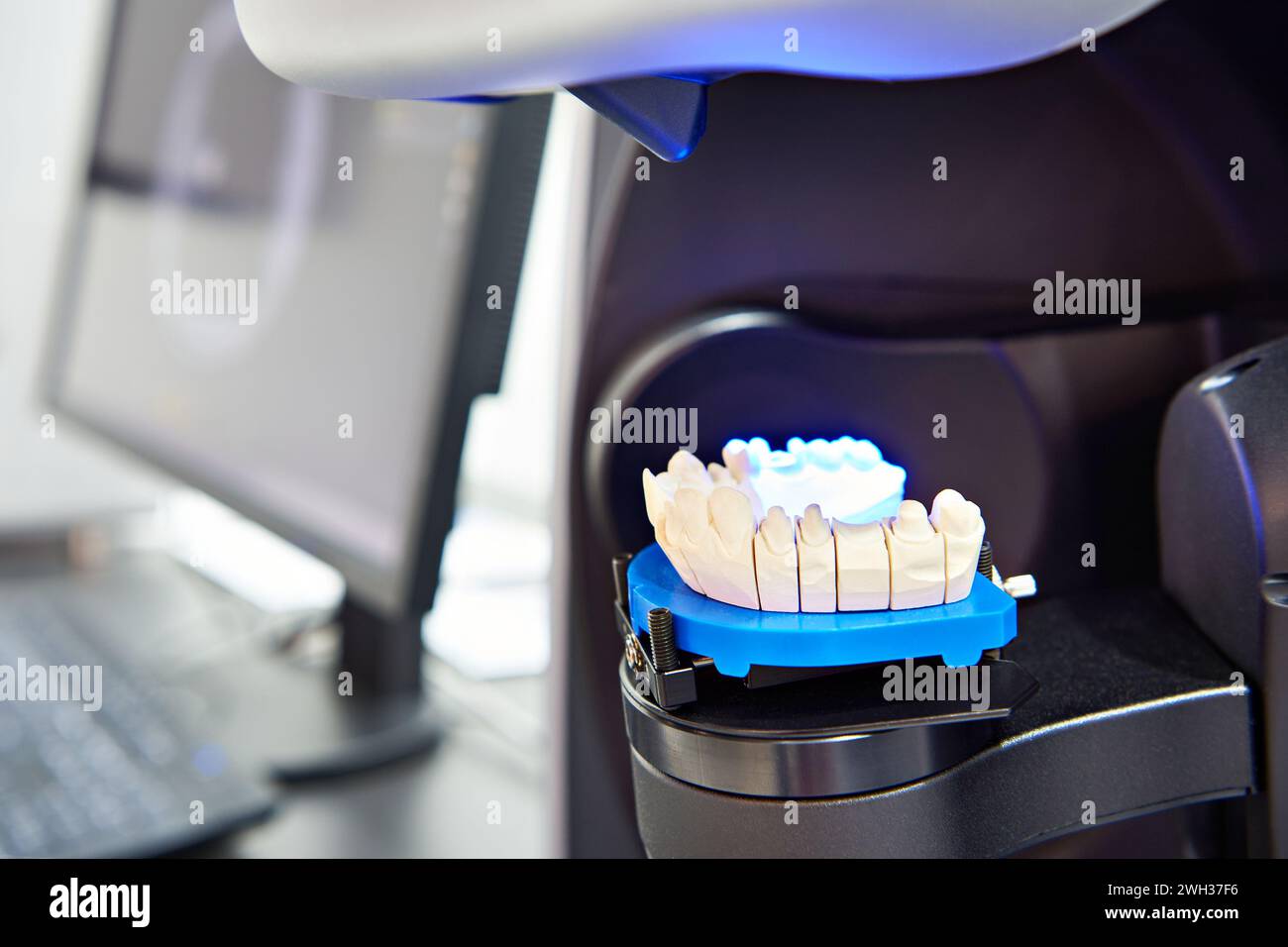 Moderno scanner odontoiatrico extraorale da laboratorio Foto Stock