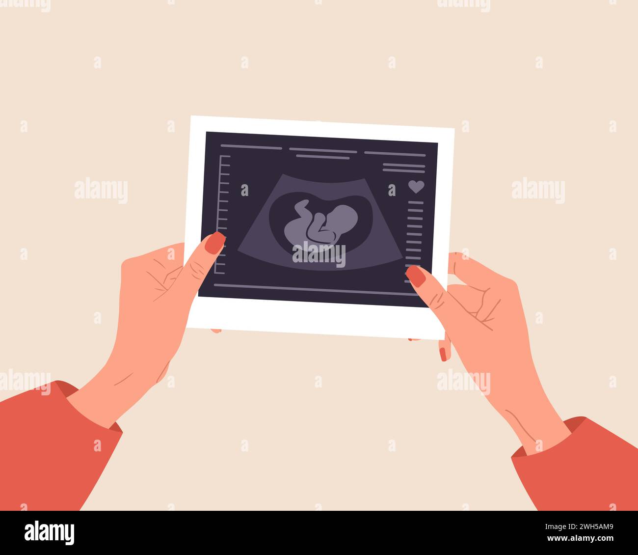 Ecografia del bambino. Mani femminili che tengono in mano la foto della silhouette del feto. Embrione nell'utero. Screening della gravidanza. Diagnostica della salute del bambino. Sonografia o. Illustrazione Vettoriale