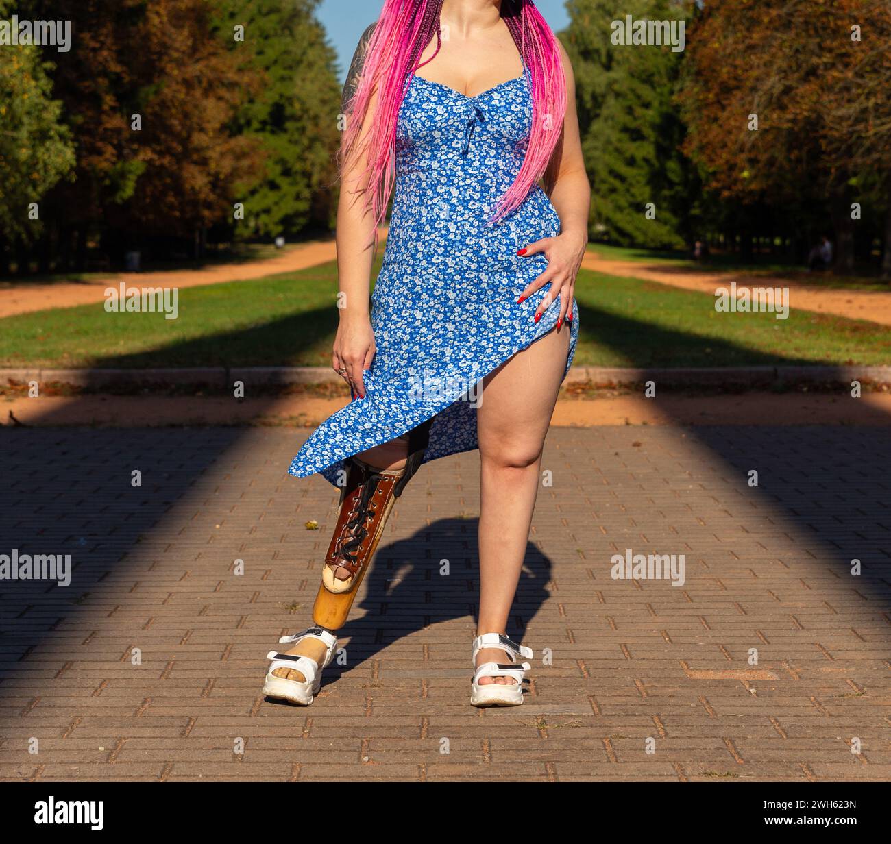 Bella giovane donna amputata in un abito che cammina nel parco durante il giorno di sole. La vita va avanti in ogni caso. Foto Stock