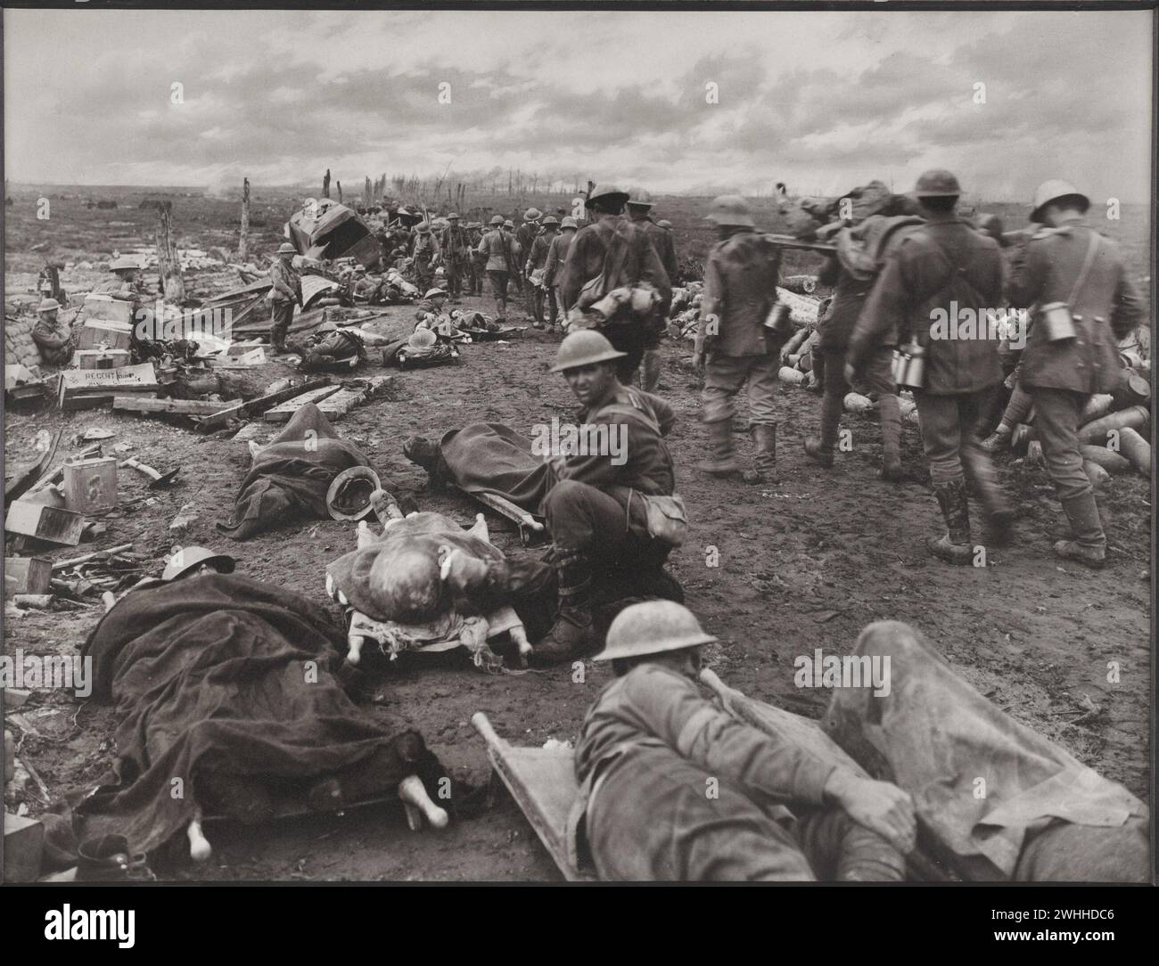 Belgio: Uomini feriti nella battaglia di Ypres del 20 settembre 1917. La battaglia della Menin Road, nella quale gli australiani presero parte di primo piano. Di ritorno dalla linea avanzata del fronte c'è un flusso continuo di feriti a piedi e prigionieri. I rifiuti lungo il lato della strada sono barelle che sopportano feriti gravemente in attesa del trasporto in ambulanza. Foto del 1917-1918 di Capt F.Hurley Foto Stock
