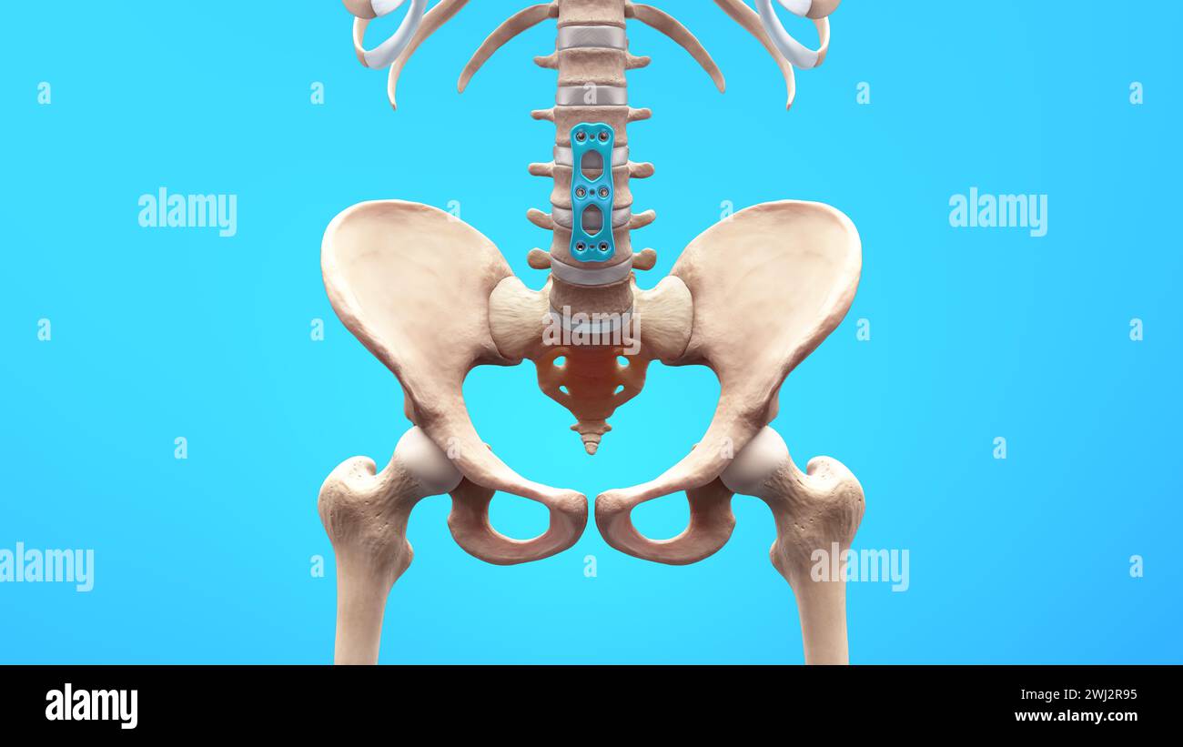 Importa c4d da c4d importa utils fusione colonna lombare per mal di schiena Foto Stock