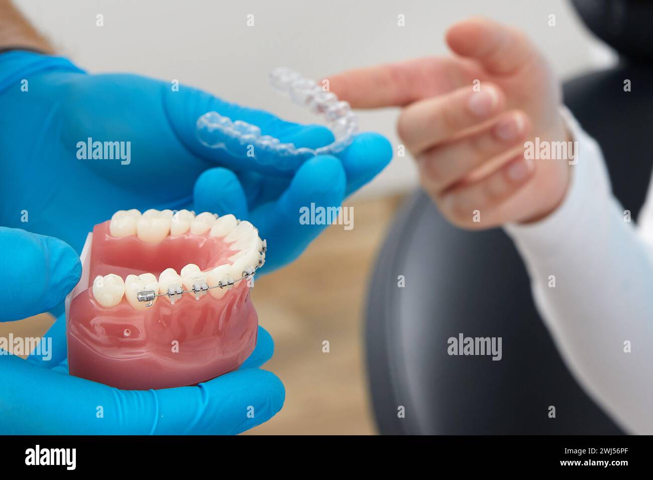 Ortodontista che mostra il modello di mandibola umana con rinforzi e allineatori a filo spiegando la differenza Foto Stock