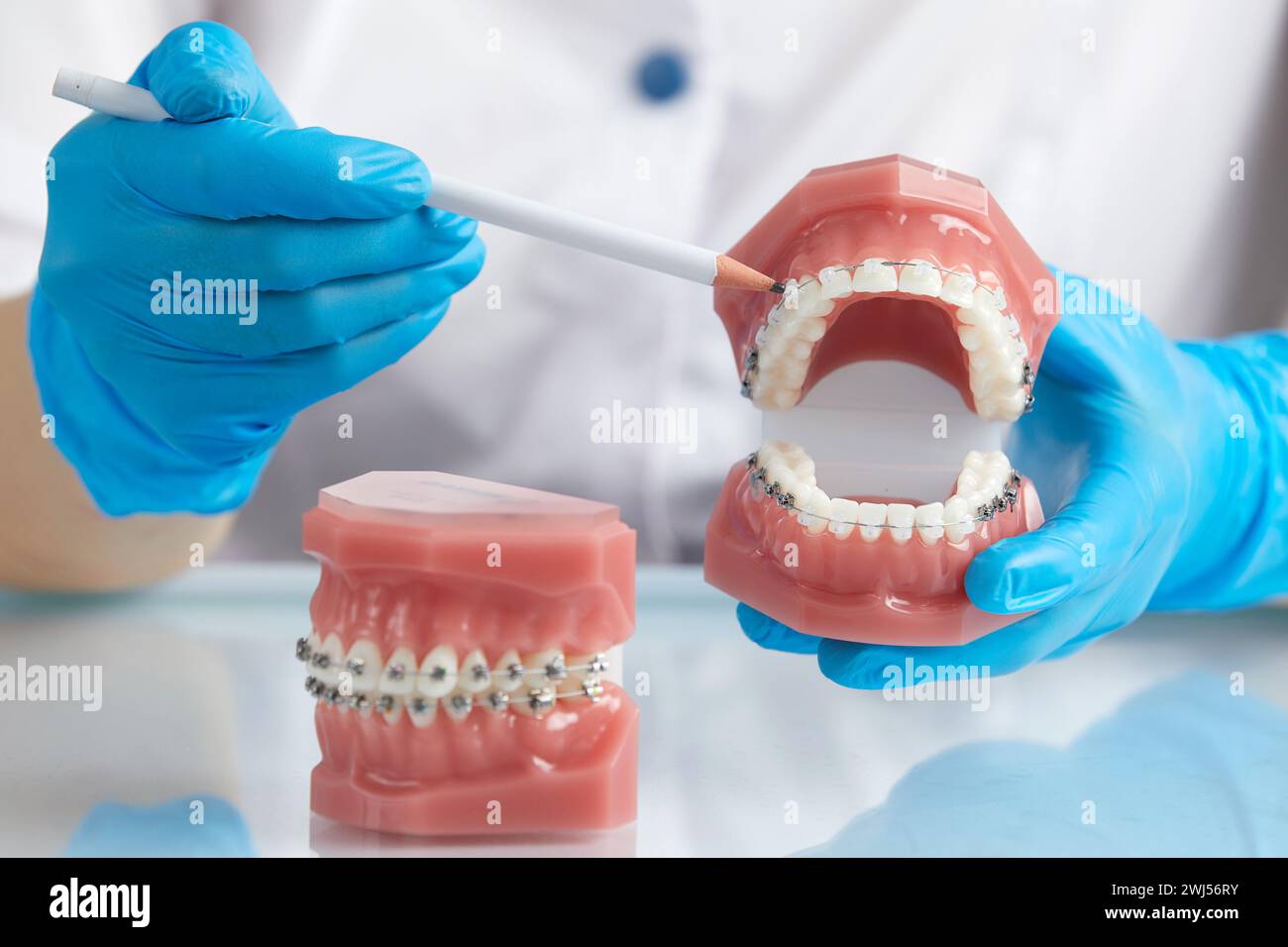 Ortodontista che mostra il modello di mandibola umana con rinforzi e allineatori a filo spiegando la differenza Foto Stock