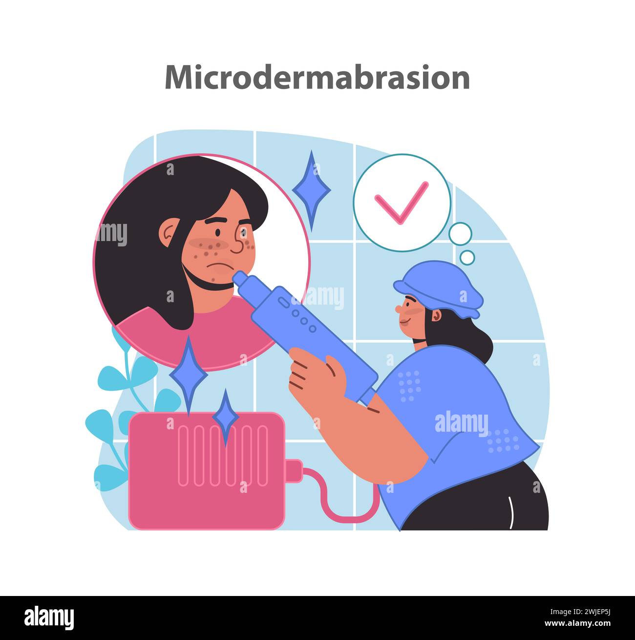 Procedura di microdermoabrasione. Una donna affetta da contenuti subisce l'esfoliazione della pelle con un dispositivo speciale per una carnagione ringiovanita. Illustrazione vettoriale piatta. Illustrazione Vettoriale