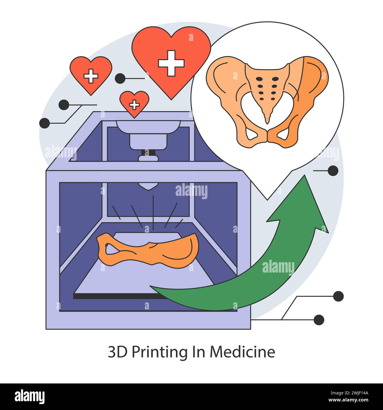 Concetto di stampa medica 3D. Trasformazione della cura del paziente con strutture ossee e modelli di organi stampati su misura. L'intersezione tra salute e high-tech. Illustrazione vettoriale piatta. Illustrazione Vettoriale