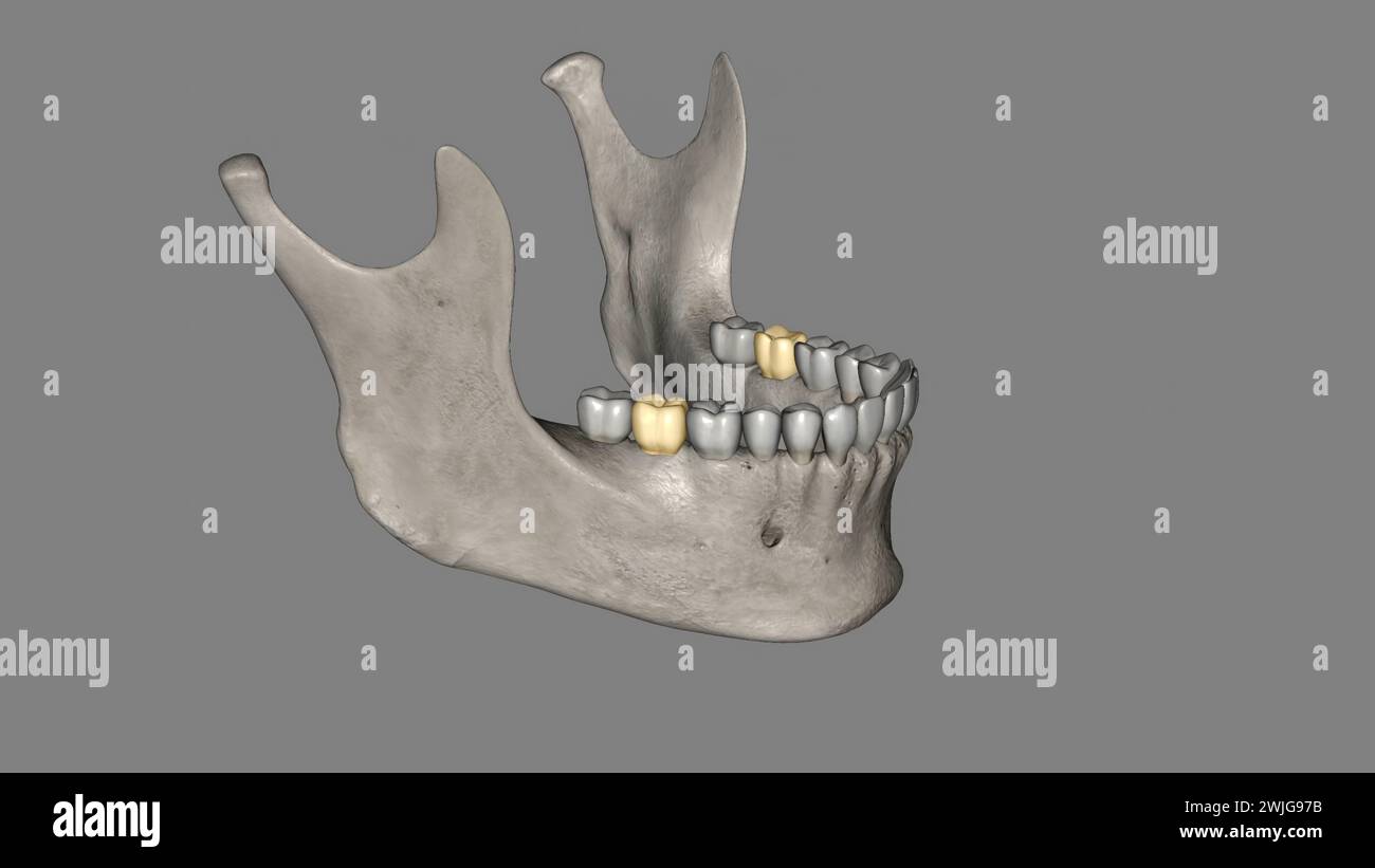 Il secondo molare mandibolare assomiglia al primo molare permanente mandibolare, tranne che il dente primario è più piccolo in tutte le sue dimensioni 3d illustra Foto Stock