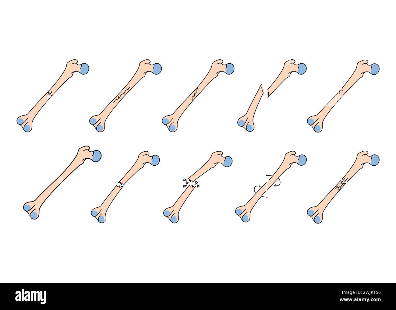 Set di icone della linea di frattura ossea. Elemento isolato vettoriale. Traccia modificabile. Illustrazione Vettoriale