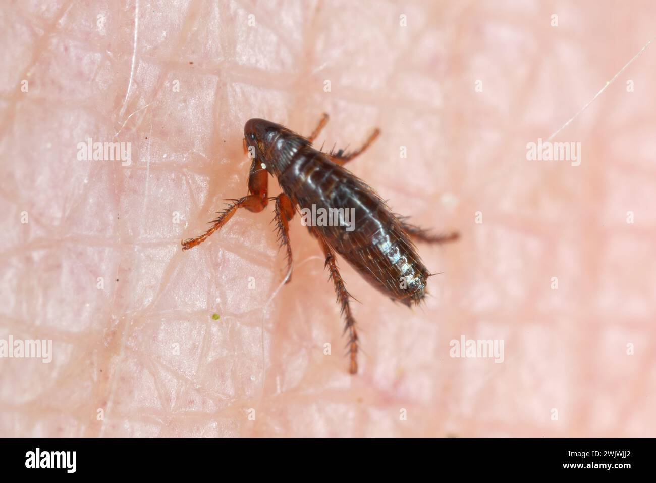 Pulci. Morsi di insetti e bere sangue sulla pelle umana. Foto Stock