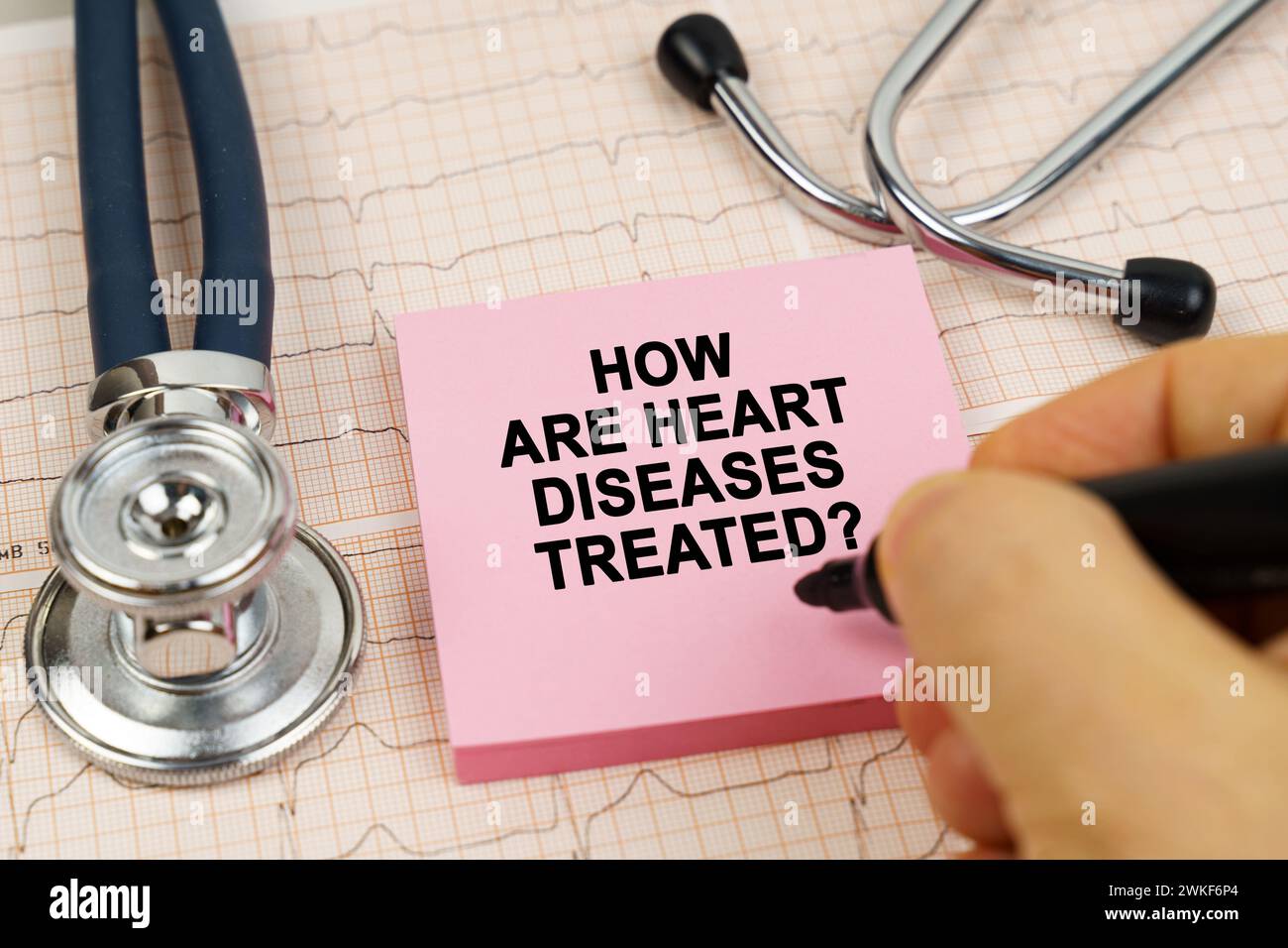 Concetto medico. Sugli cardiogrammi c'è uno stetoscopio e un adesivo con l'iscrizione - come vengono trattate le malattie cardiache Foto Stock