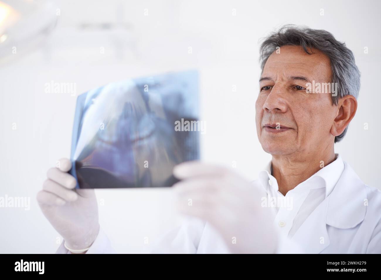 Dentista anziano, uomo e raggi X di denti per chirurgia dentale, assistenza sanitaria e salute orale con trattamento in clinica. Medico con analisi di Foto Stock