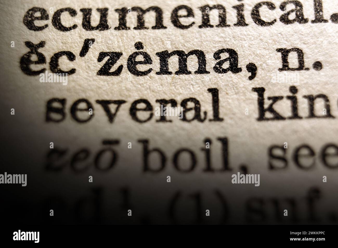 Definizione di eczema di parola sulla pagina del dizionario, primo piano Foto Stock