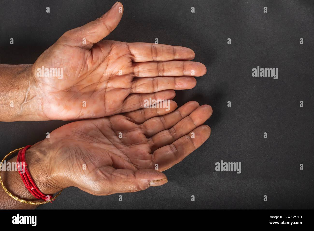 Primo piano delle mani aperte di una donna anziana su uno sfondo nero. Foto Stock