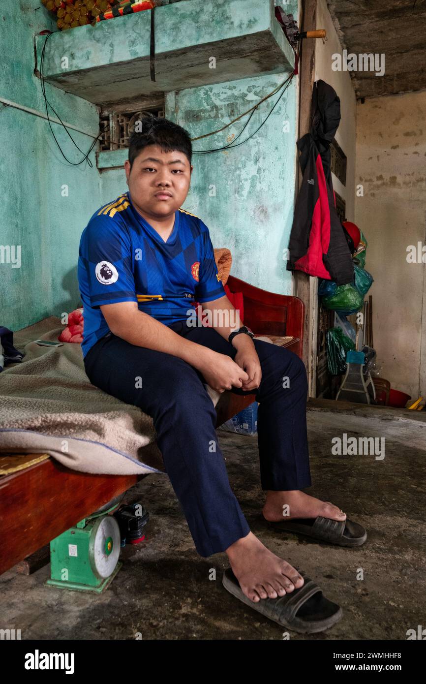 Agente Orange vittime in Vietnam, inquinamento da diossina Foto Stock
