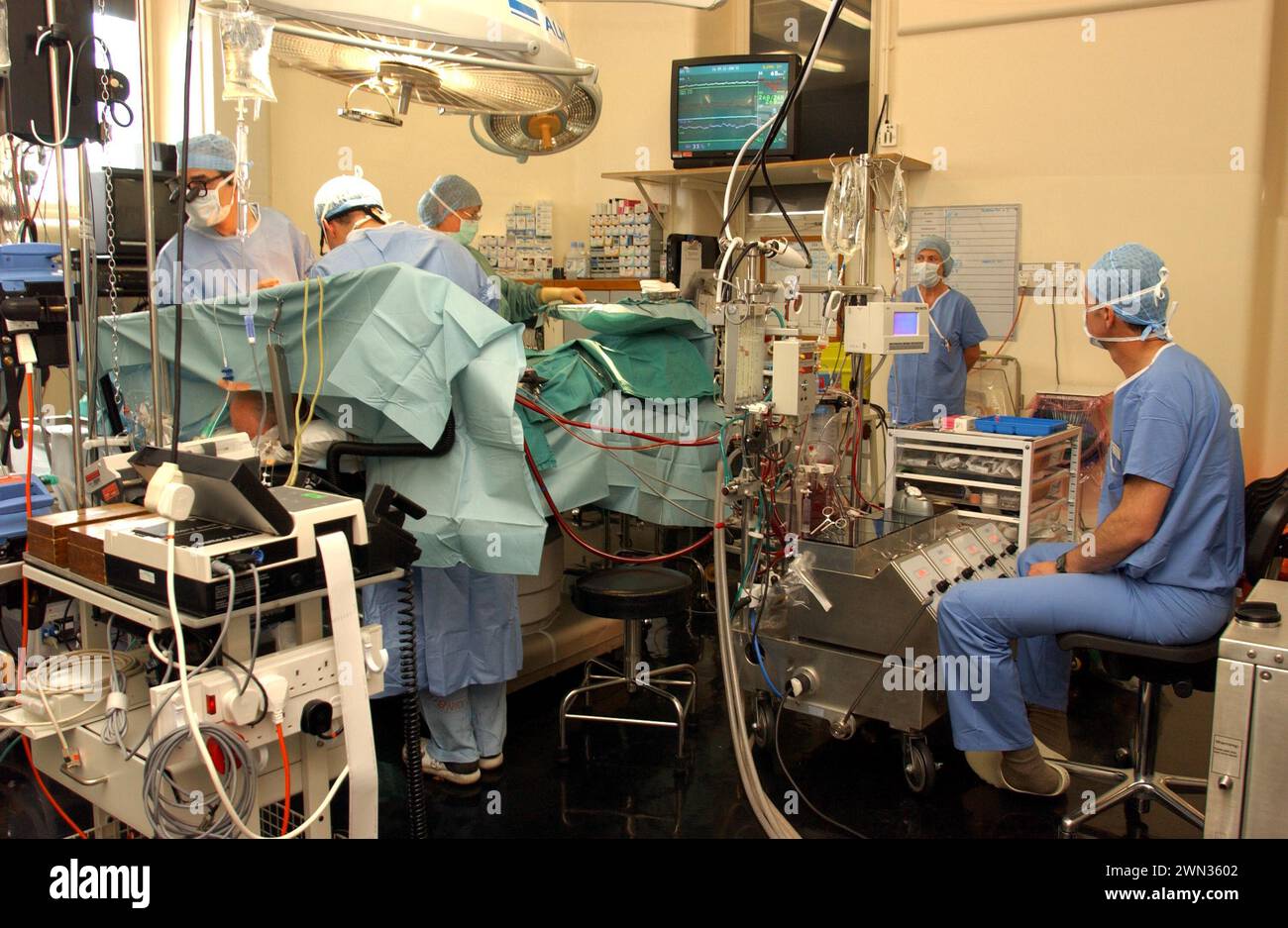 Il chirurgo Cirro Campanella, a sinistra, esegue un intervento chirurgico a cuore aperto presso l'Edinburgh Royal Infirmary, in Scozia. Foto Stock