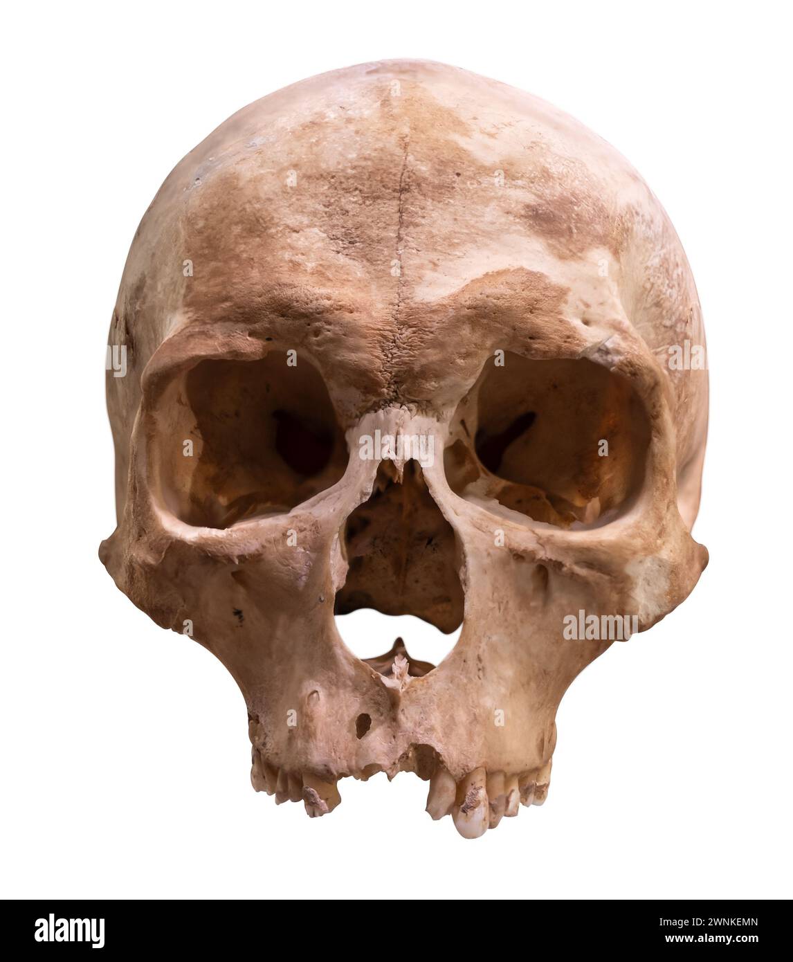 Un antico cranio umano conservato per la scienza medica, isolato su sfondo bianco Foto Stock