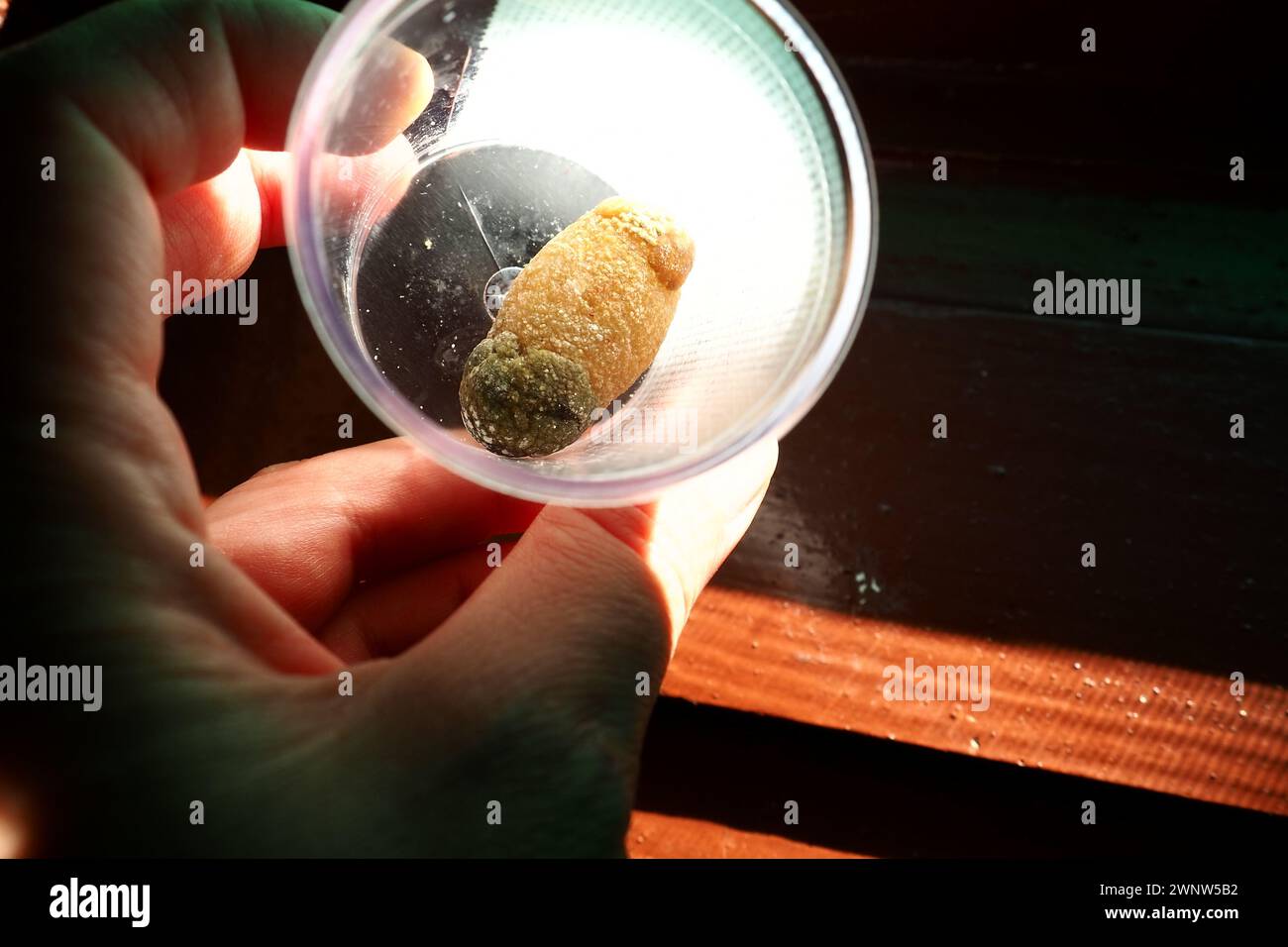 Malattia del calcoli biliari, colelitiasi - la formazione di pietre, calcoli nella cistifellea, dotti biliari. Calcoli biliari. Un grande gallone rimosso da a. Foto Stock