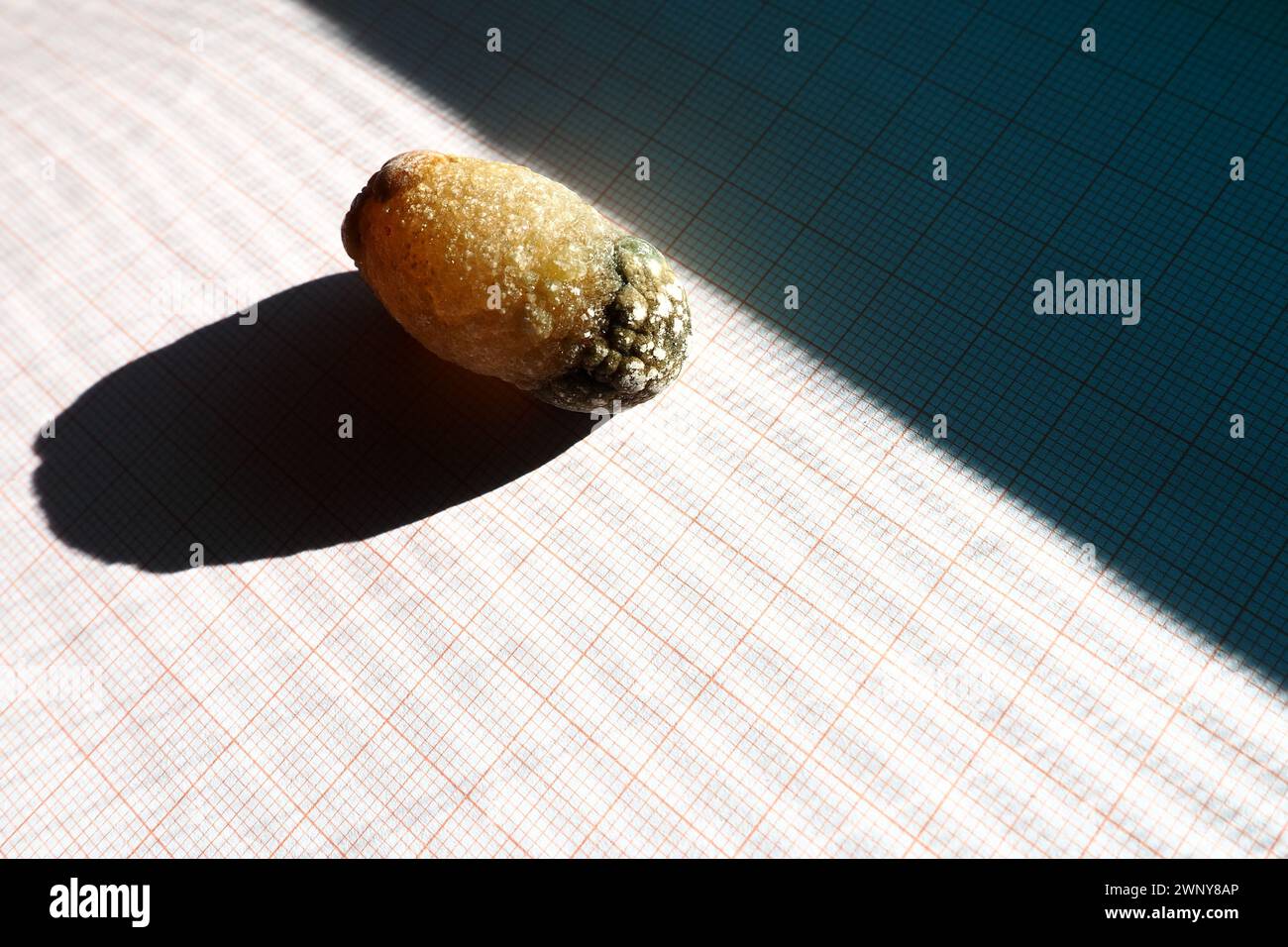 Malattia del calcoli biliari, colelitiasi - la formazione di pietre, calcoli nella cistifellea, dotti biliari. Calcoli biliari. Un grande gallone rimosso da a. Foto Stock