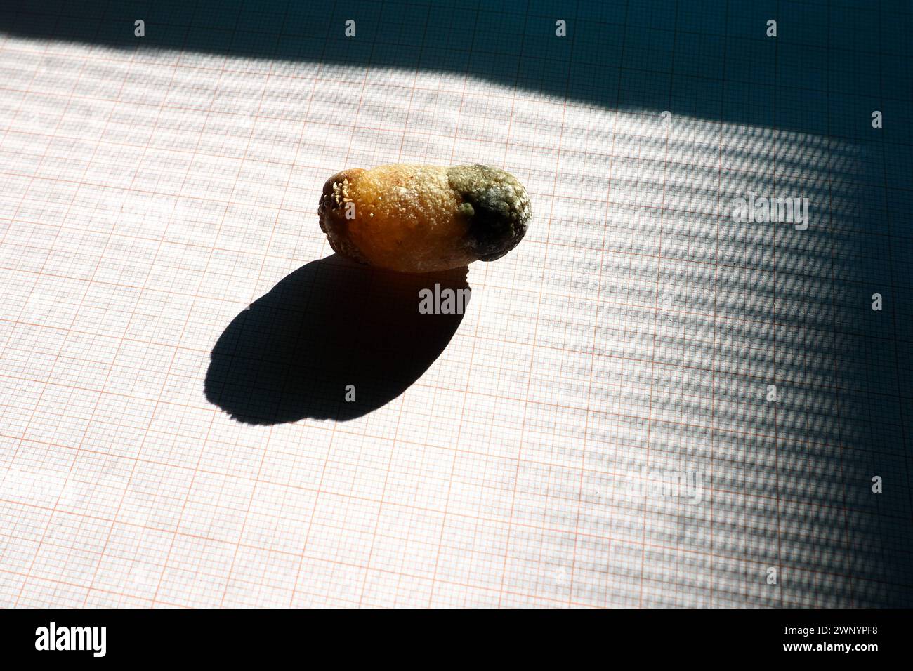 Malattia del calcoli biliari, colelitiasi - la formazione di pietre, calcoli nella cistifellea, dotti biliari. Calcoli biliari. Un grande gallone rimosso da a. Foto Stock