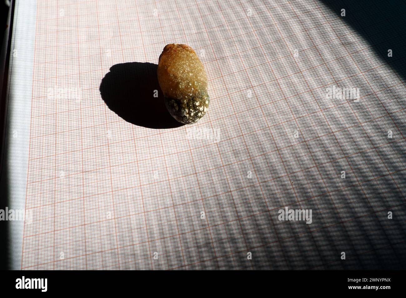 Malattia del calcoli biliari, colelitiasi - la formazione di pietre, calcoli nella cistifellea, dotti biliari. Calcoli biliari. Un grande gallone rimosso da a. Foto Stock