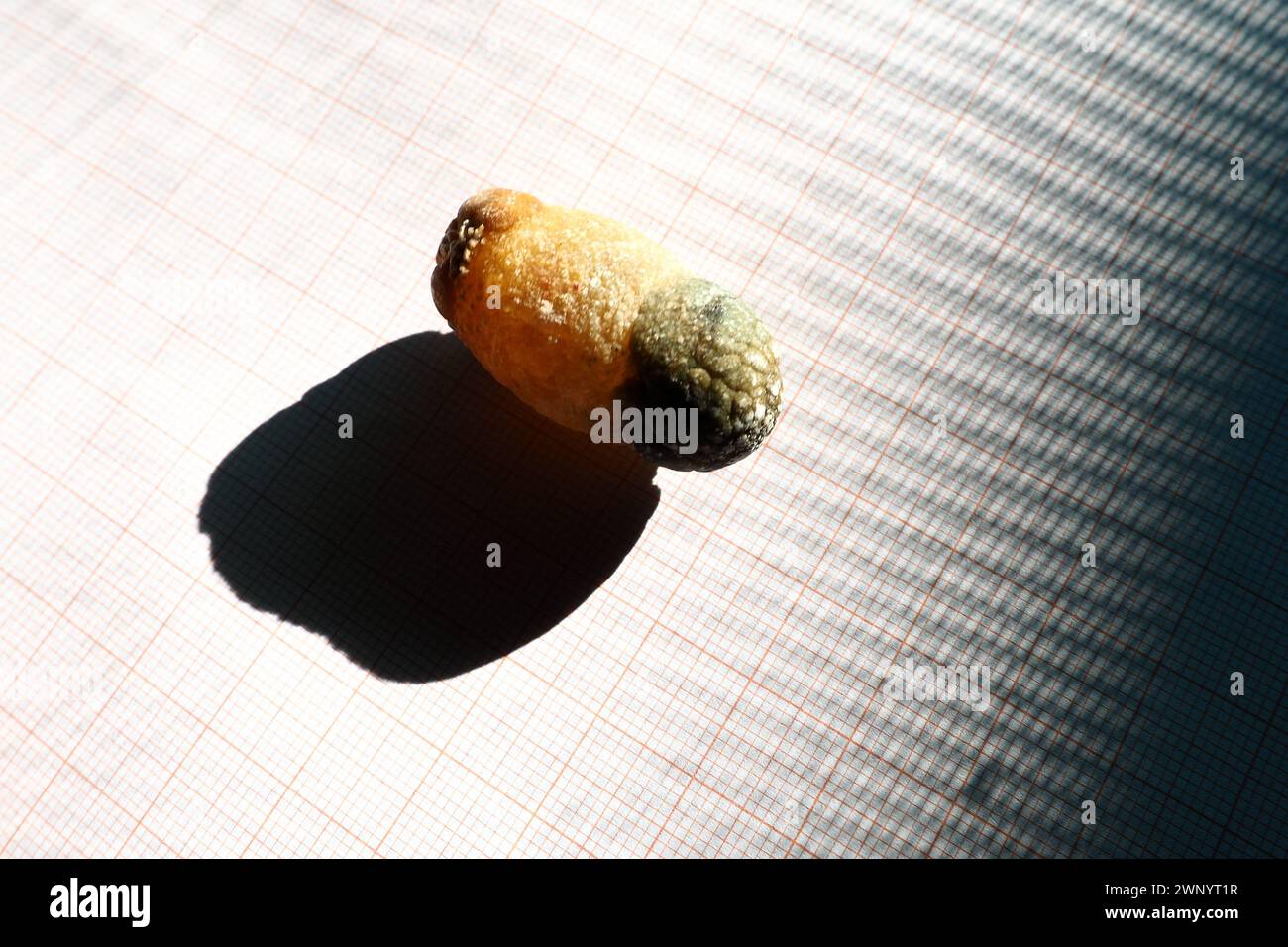 Malattia del calcoli biliari, colelitiasi - la formazione di pietre, calcoli nella cistifellea, dotti biliari. Calcoli biliari. Un grande gallone rimosso da a. Foto Stock