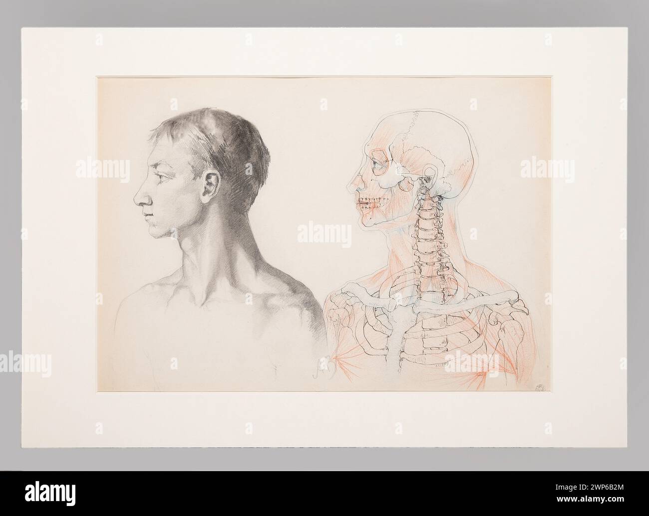 Busto di profilo con disegno anatomico dello scheletro, creato da Anna Bili Ska-Bohdanowiczowa tra il 1883 e il 1884, che mostra la struttura scheletrica e lo studio per scopi accademici. Foto Stock