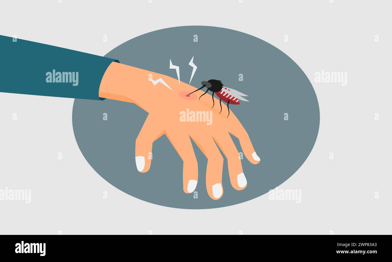 Una zanzara morde la mano umana. Concetto di febbre dengue o epidemia di malaria. Illustrazione vettoriale. Illustrazione Vettoriale