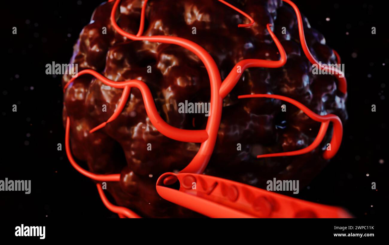 il rendering 3d del cancro richiede un apporto di sangue per fornire i nutrienti e l'ossigeno necessari per crescere e sopravvivere Foto Stock