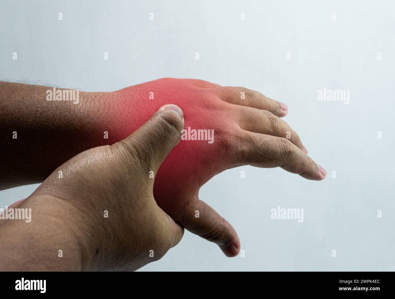 Il dorso della mano è malato o ferito. L'area dolorosa è tenuta con l'altra mano e c'è un segno rosso. Su sfondo bianco Foto Stock