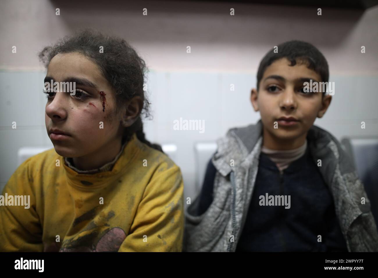 Gaza. 10 marzo 2024. Questa foto scattata il 9 marzo 2024 mostra i bambini feriti all'al-Aqsa Martyrs Hospital nella Striscia di Gaza centrale. Almeno 18 palestinesi sono stati uccisi in attacchi aerei israeliani che hanno preso di mira le case nel centro di Gaza sabato, secondo la TV palestinese gestita dallo Stato. Crediti: Xinhua/Alamy Live News Foto Stock