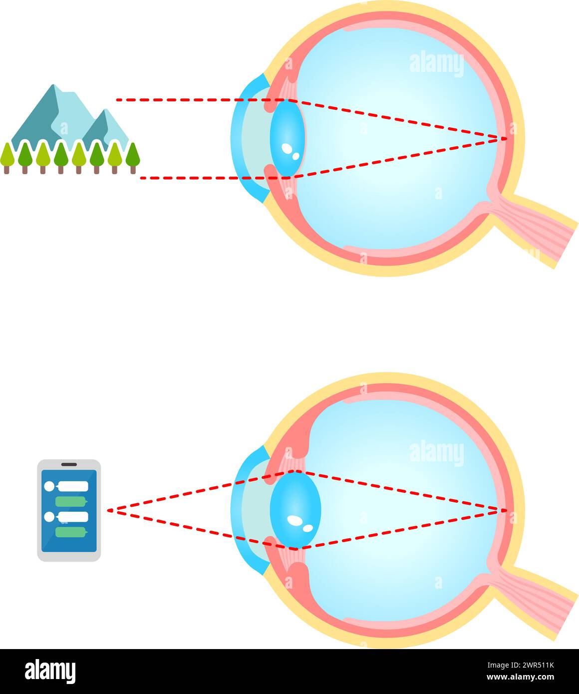 Meccanismo del bulbo oculare per guardare lontano e vicino. Illustrazione vettoriale. Illustrazione Vettoriale