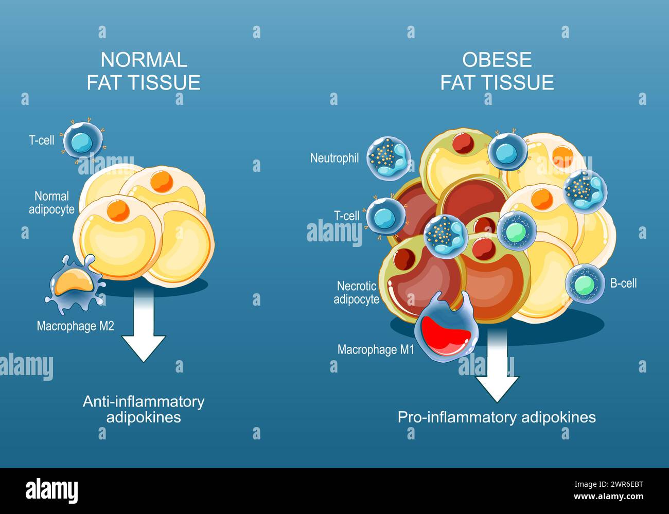 Tessuto adiposo, obesità e infiammazione. Primo piano di una cella adiposa. Patologia dell'obesità. adipochine antinfiammatorie e pro-infiammatorie. Metabolismo lipidico. H Illustrazione Vettoriale