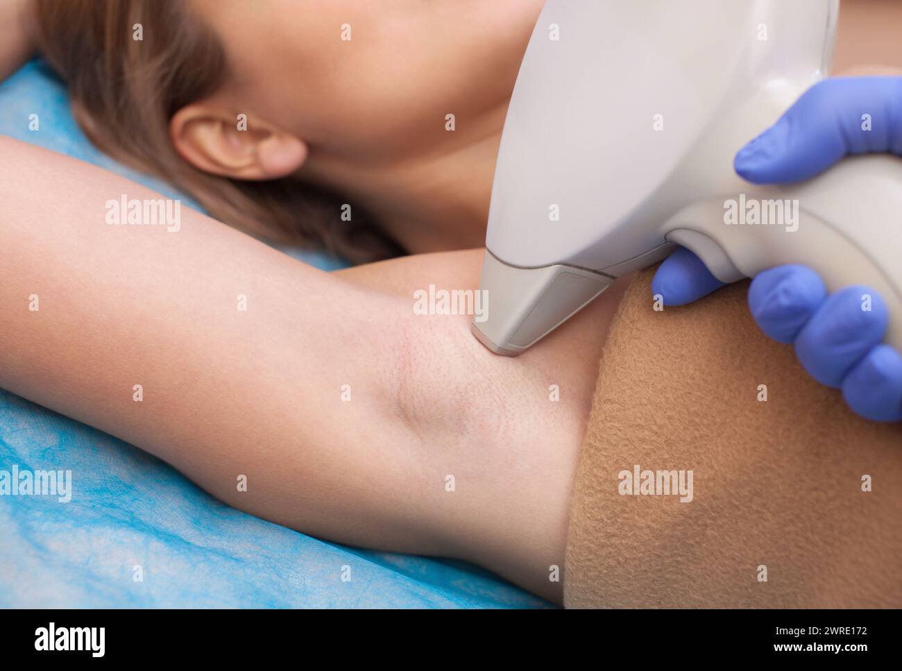 Il cosmetologo esegue la procedura di epilazione laser nella zona delle ascelle, a una giovane donna in un salone di bellezza. Foto Stock