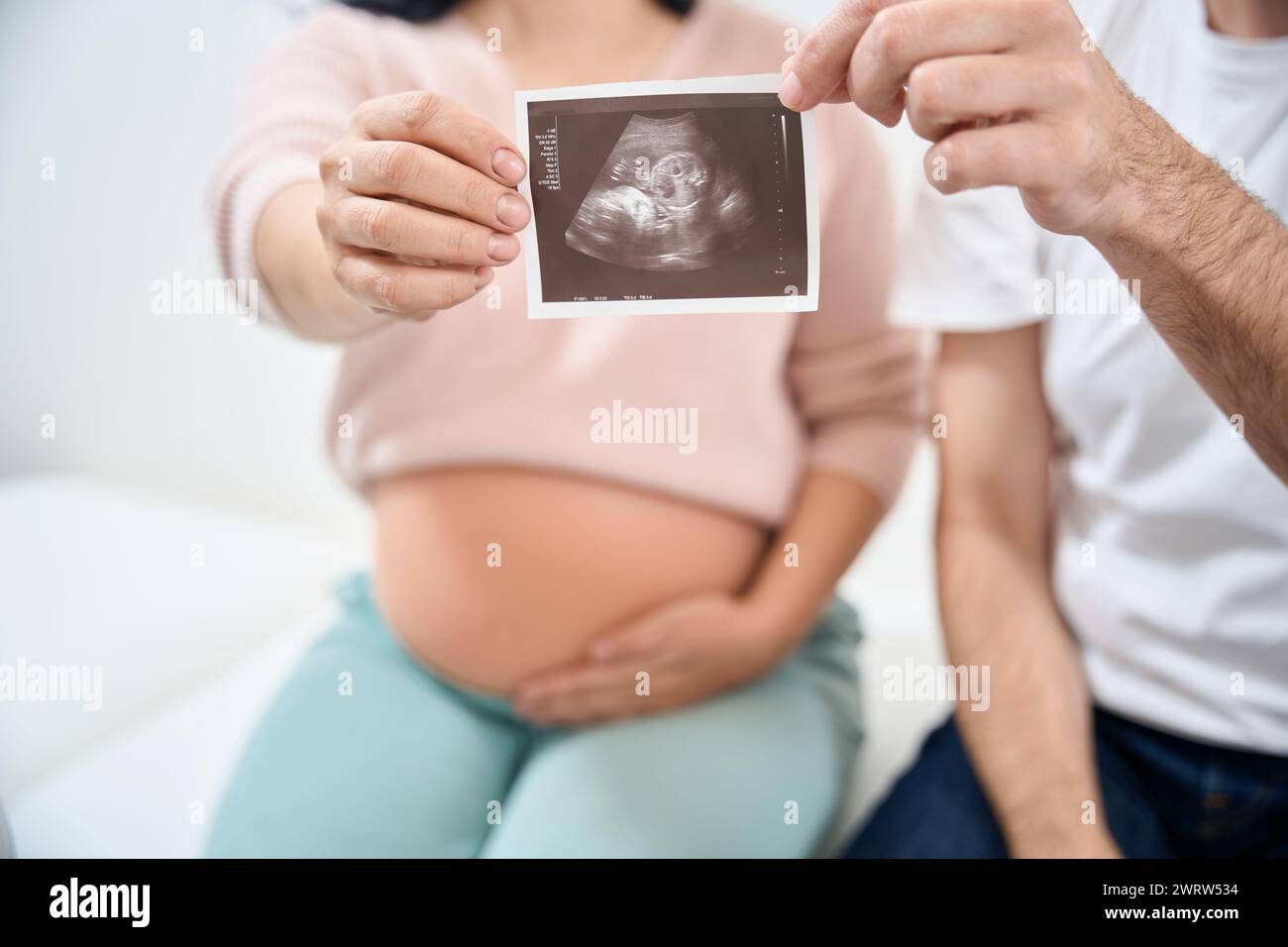 Felice coppia seduta sul divano esame in studio medici e tenendo in mano l'immagine ultrasonografia del loro bambino sano, amore profondo e pula Foto Stock