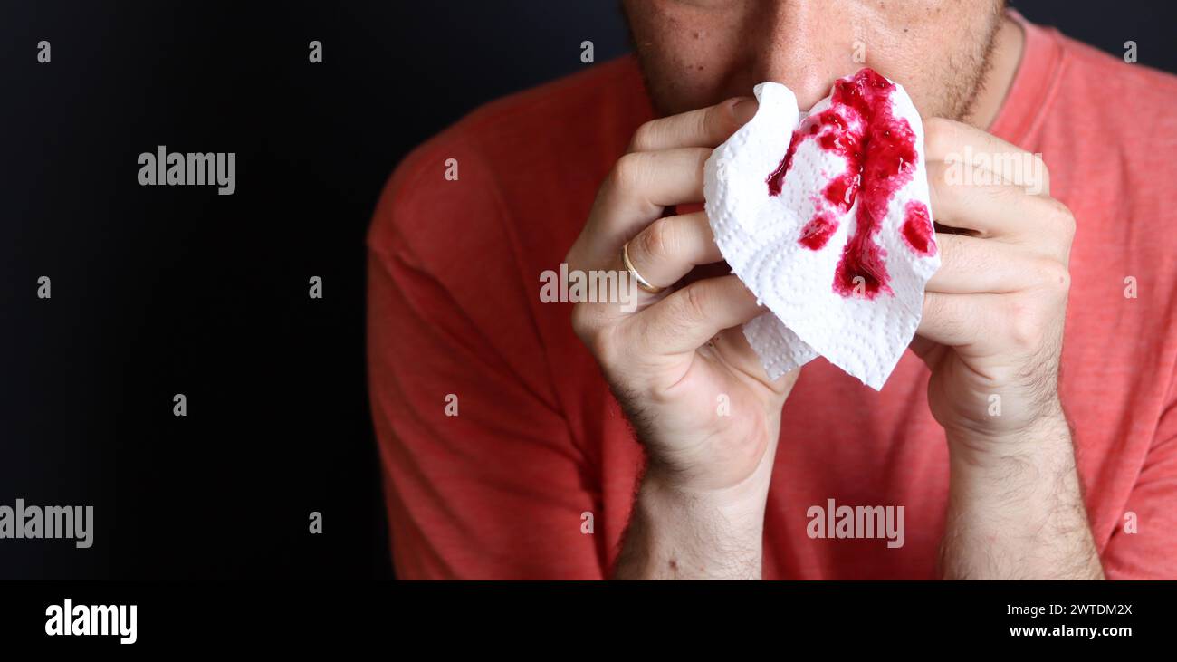 Uomo che tiene in mano un fazzoletto sanguinoso, primo piano Foto Stock