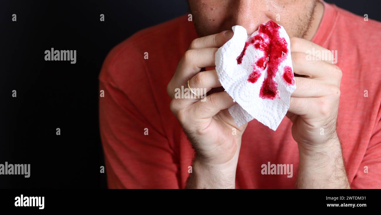 Uomo che tiene in mano un fazzoletto sanguinoso, primo piano Foto Stock