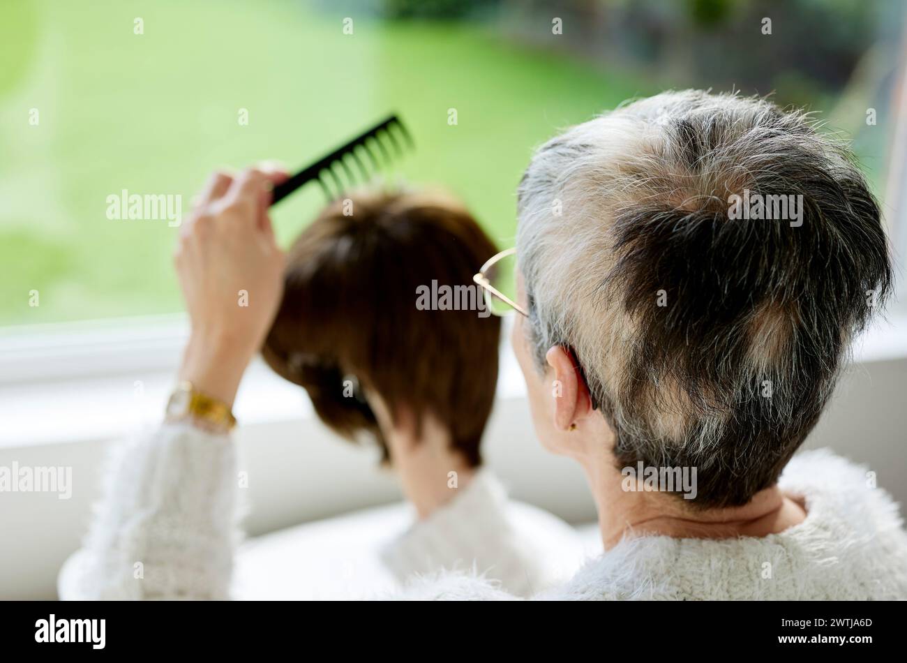 Donna con Alopecia che combatte una parrucca Foto Stock