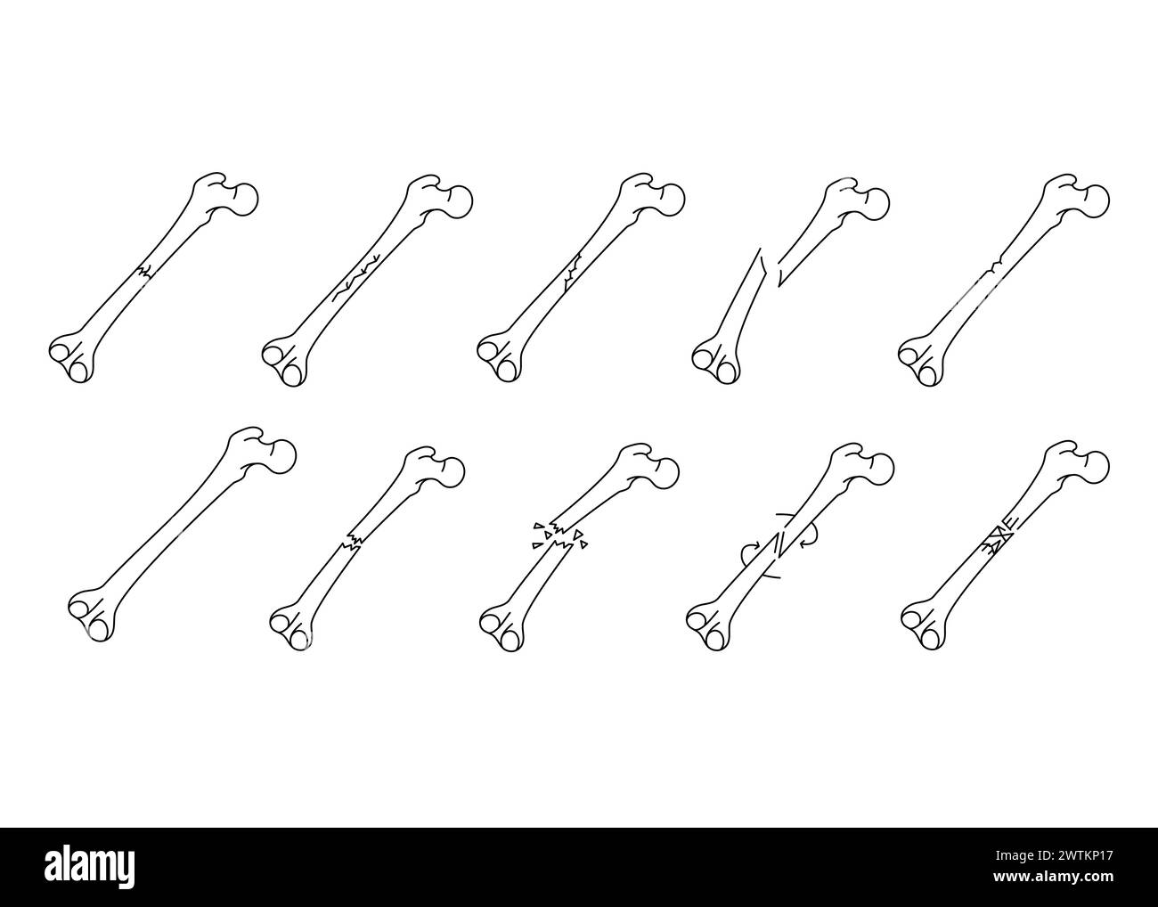 Set di icone della linea di frattura ossea. Elemento isolato vettoriale. Traccia modificabile. Illustrazione Vettoriale