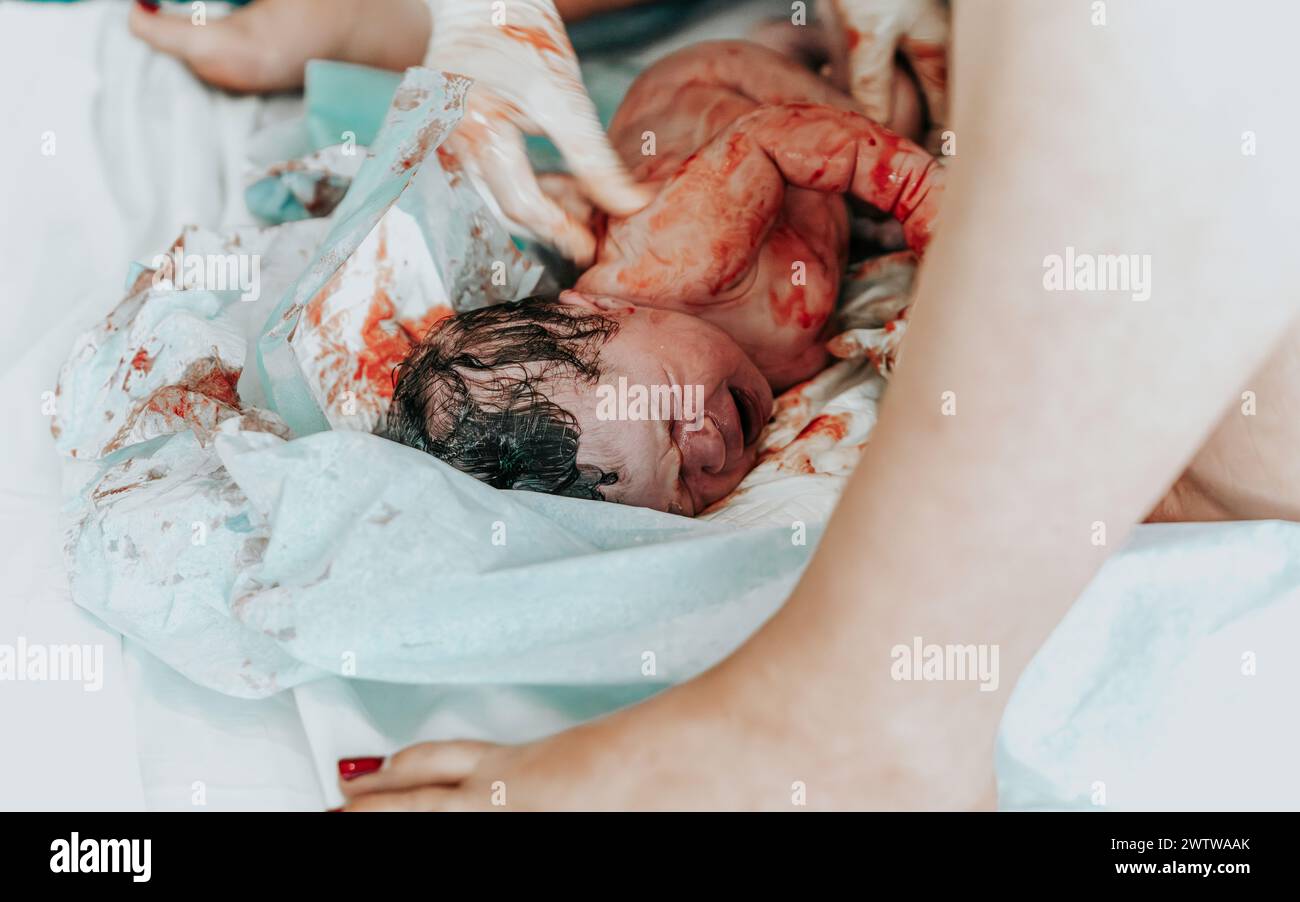 Immagine di nascita autentica: Una bambina appena nata piangente con i capelli scuri coperti di sangue pochi istanti dopo la nascita. Cordone ombelicale ancora attaccato. Foto Stock