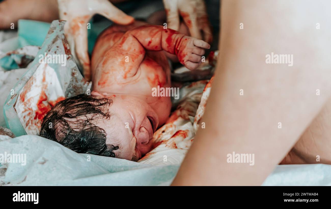 Immagine di nascita autentica: Una bambina appena nata piangente con i capelli scuri coperti di sangue pochi istanti dopo la nascita. Cordone ombelicale ancora attaccato. Foto Stock