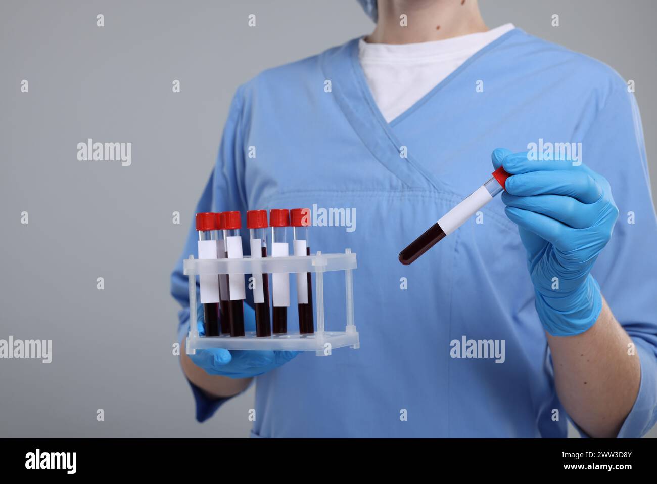 Analisi di laboratorio. Medico con campioni di sangue in provette su sfondo grigio chiaro Foto Stock