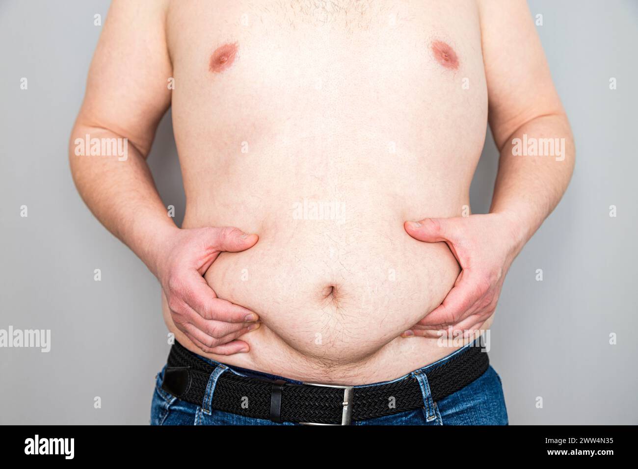 Le mani di un uomo irriconoscibile afferrano il grasso della pancia in sovrappeso. Foto Stock