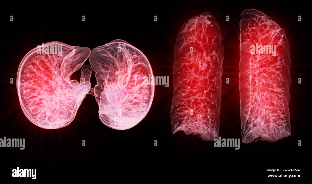 Immagine di rendering TC toracica o polmonare 3d che mostra trachea e polmoni nel sistema respiratorio. Foto Stock